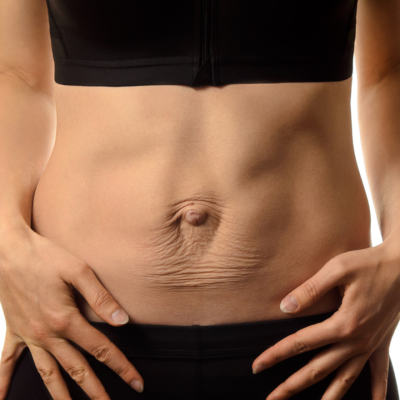 Recupera-tu-diástasis-pww19w7xb7l97ps90my0v11rpupe62ek4guh3j79m8